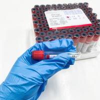 Tubo de vacío de sangre de PET de vidrio con tapa roja para hospital, 13 * 75 mm 13 * 100 mm 16 * 100 mm